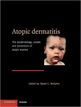 کتاب زبان آتوپیک درماتیتیس  Atopic Dermatitis The Epidemiology Causes and Prevention of Atopic Eczema 1st Edition
