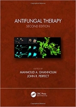 کتاب آنتی فانگال تراپی Antifungal Therapy 2nd Edition Kindle Edition