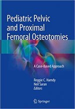 کتاب پدیاتریک پلویک اند پروگزیمال فمورال استئوتومیز Pediatric Pelvic and Proximal Femoral Osteotomies, 1st Edition2019