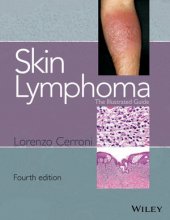 کتاب اسکین لیمفوما Skin Lymphoma : The Illustrated Guide