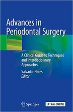 Advances in Periodontal Surgery : A Clinical Guide to Techniques and Interdisciplinary Approach