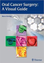 کتاب اورال کانسر سرجری Oral Cancer Surgery : A Visual Guide