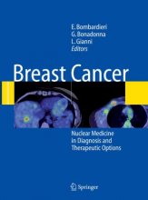کتاب بریست کانسر Breast Cancer : Nuclear Medicine in Diagnosis and Therapeutic Options