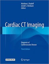 Cardiac CT Imaging : Diagnosis of Cardiovascular Disease